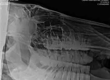 Examen radiologique du cheval permettant de vérifier l’intégrité des couronnes de réserve et des racines dentaires ainsi que des sinus. Radiographie des dents du cheval